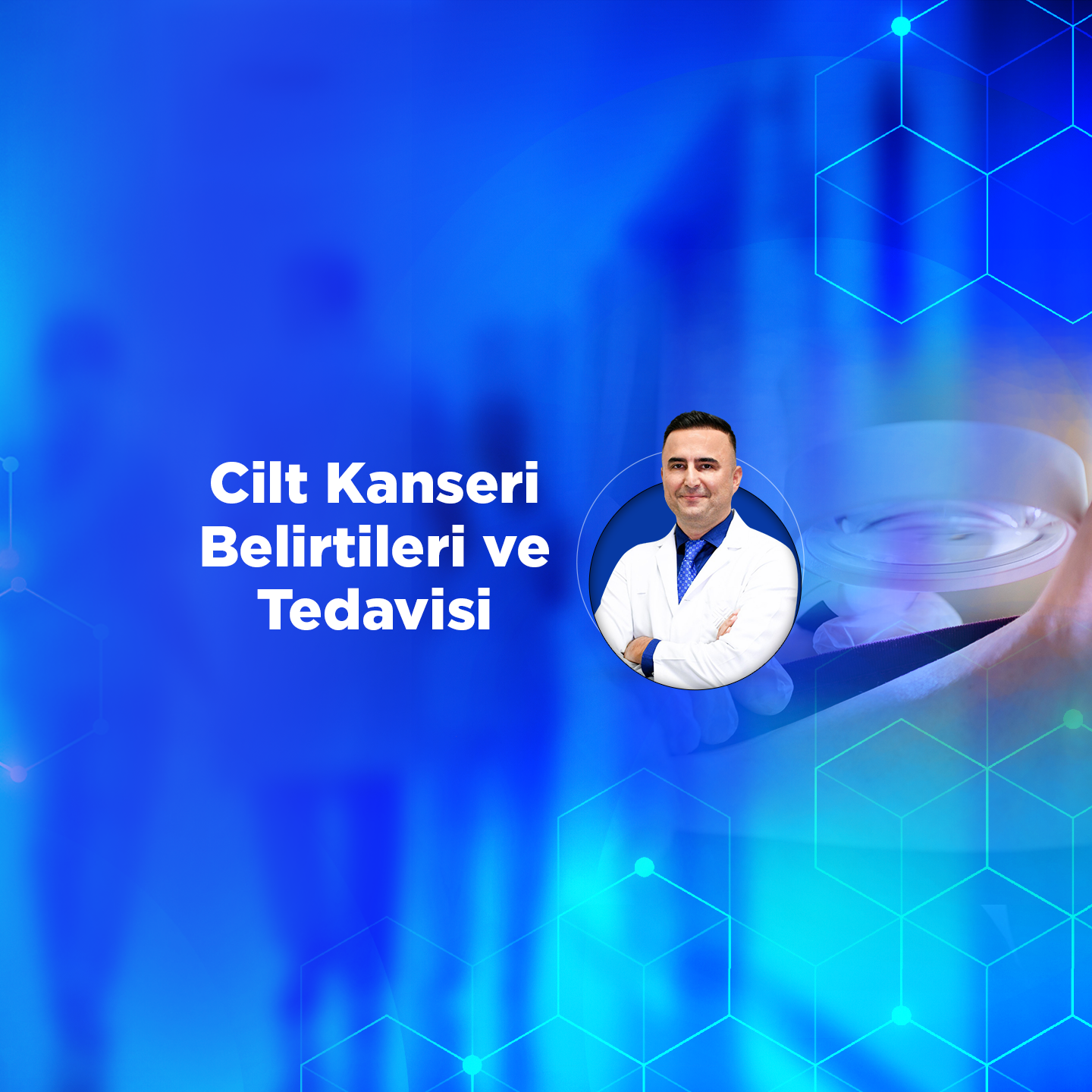 Cilt Kanseri Belirtileri ve Tedavisi
