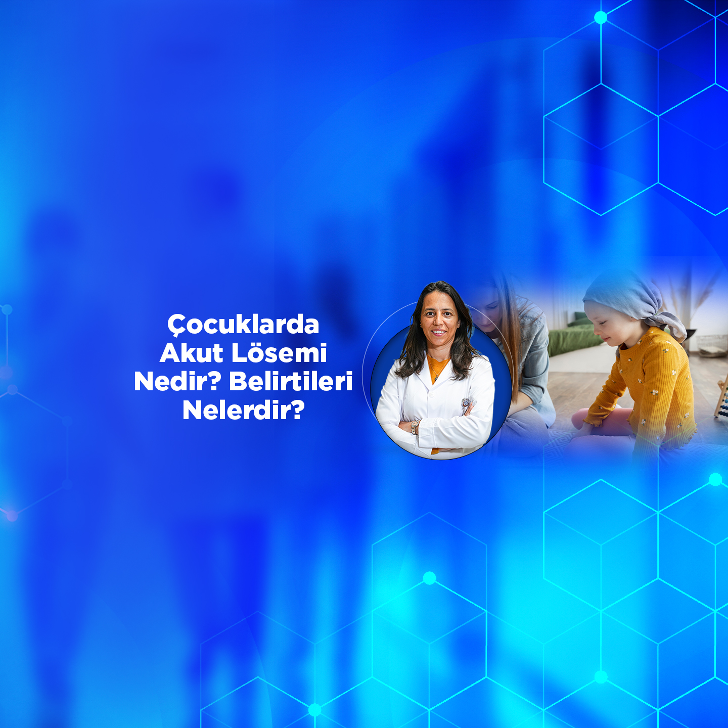 Çocuklarda Akut Lösemi Nedir? Belirtileri Nelerdir?
