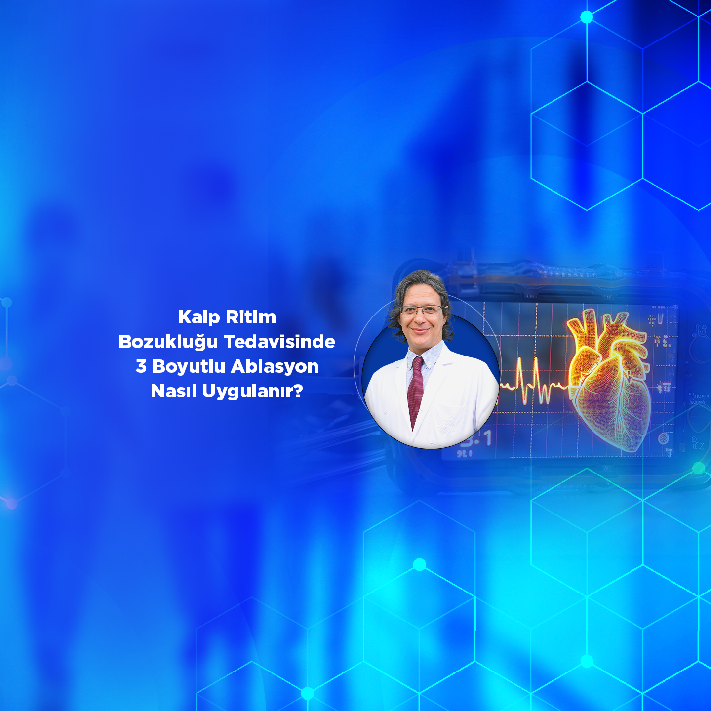 Kalp Ritim Bozukluğu Tedavisinde 3 Boyutlu Ablasyon Nasıl Uygulanır?