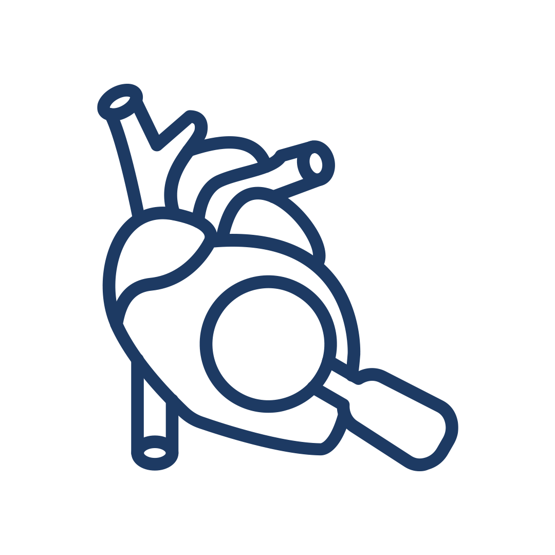 Sol Ventrikül Yapay Kalp Destek Cihazı: LVAD