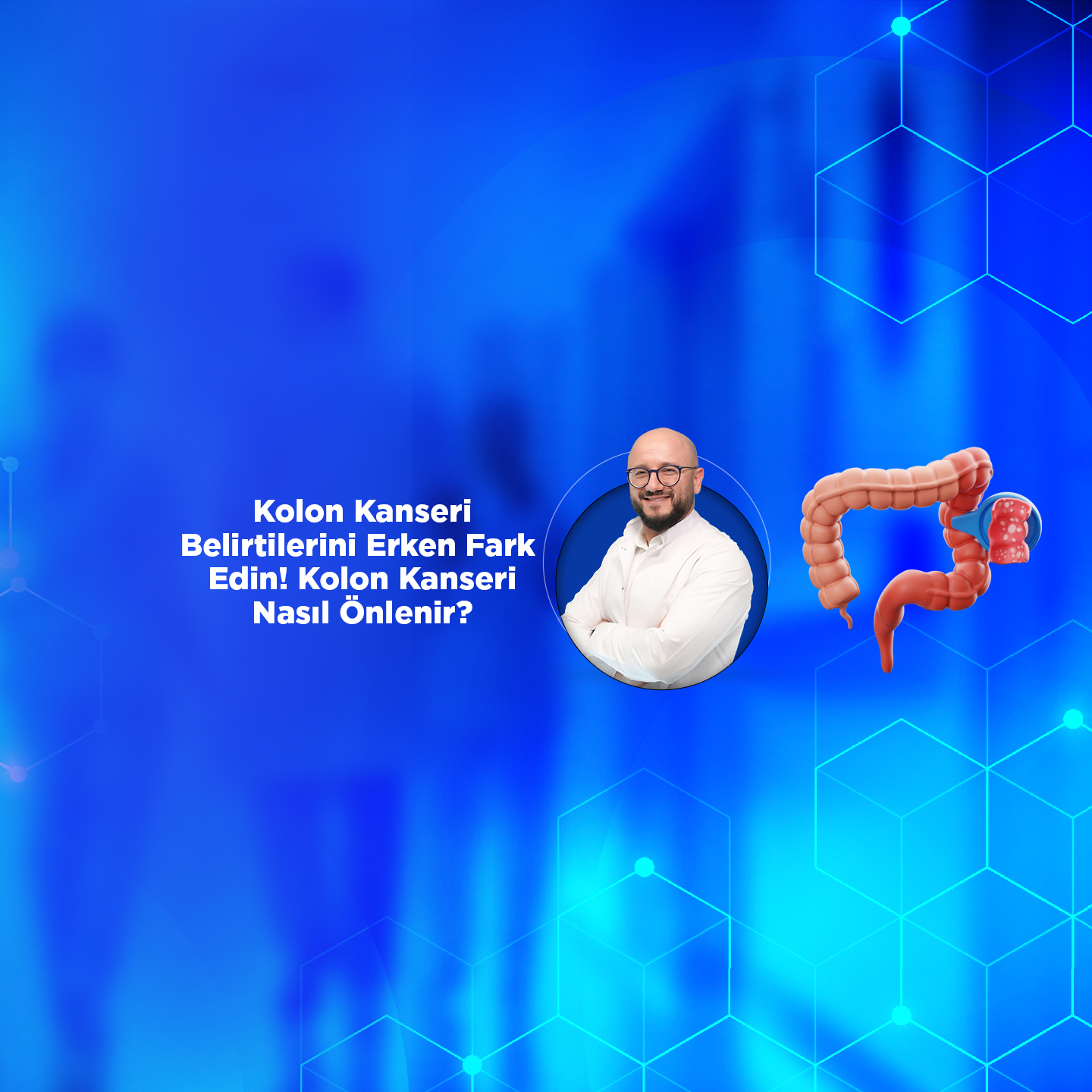 Kolon Kanseri Belirtilerini Erken Fark Edin! Kolon Kanseri Nasıl Önlenir?