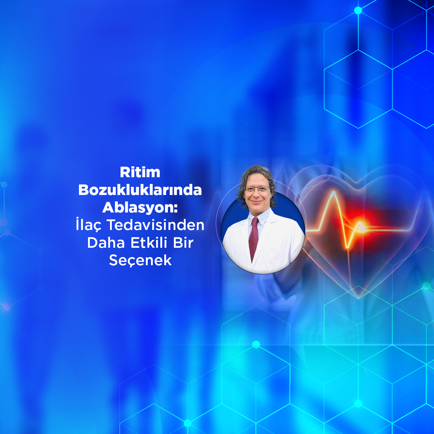 Ritim Bozukluklarında Ablasyon: İlaç Tedavisinden Daha Etkili Bir Seçenek