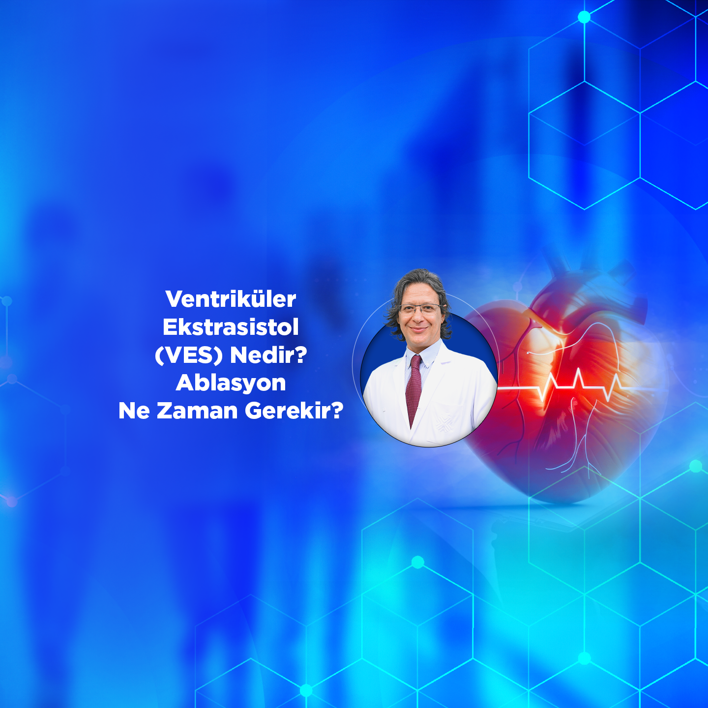 Ventriküler Ekstrasistol (VES) Nedir? Ablasyon Ne Zaman Gerekir?