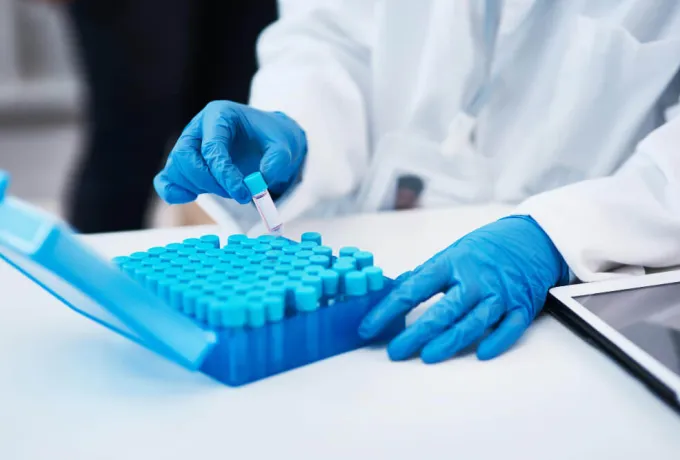 AST Testi Nedir? AST Yüksekliği ve Düşüklüğü