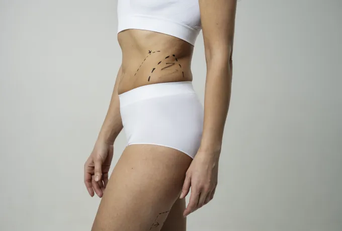 liposuction yöntemleri