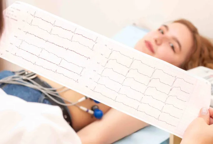  EKG