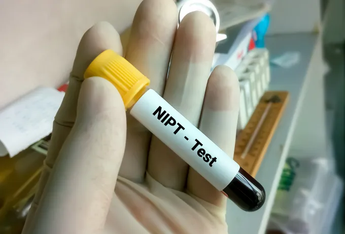 NİPT TESTİ