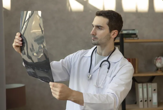 fibroz displazi nedir