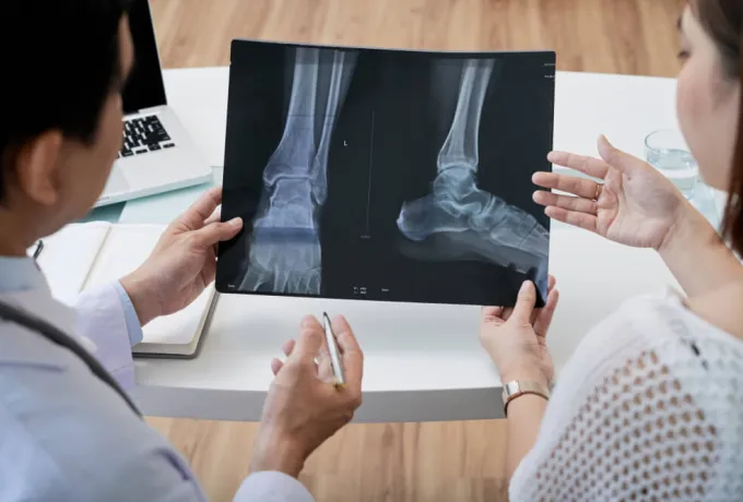 Non-Ossifying Fibroma
