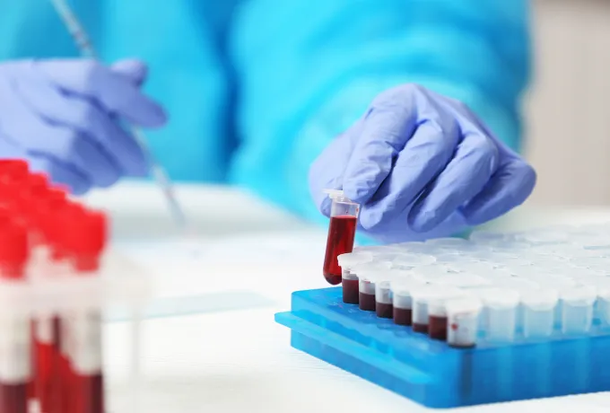 Tam Kan Sayımı Testi Nedir? Kan Tahlili Sonuçlarının Anlamları Nelerdir?