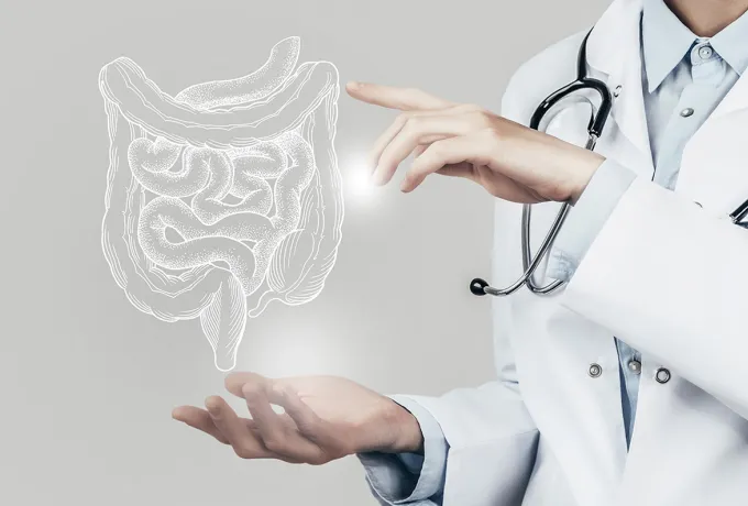 Kolon (Kalın Bağırsak) Kanseri