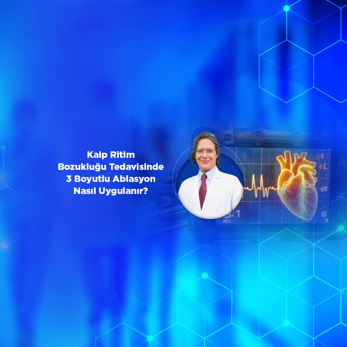 Kalp Ritim Bozukluğu Tedavisinde 3 Boyutlu Ablasyon Nasıl Uygulanır?