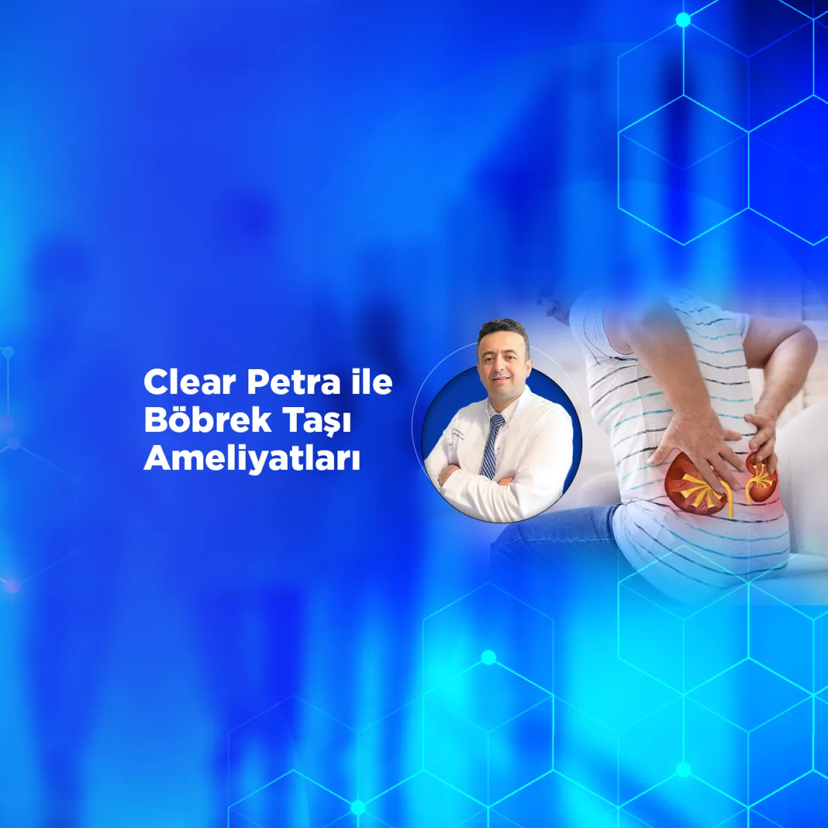 Clear Petra ile Böbrek Taşı Ameliyatları: Minimal İnvaziv Yöntemle Hızlı İyileşme