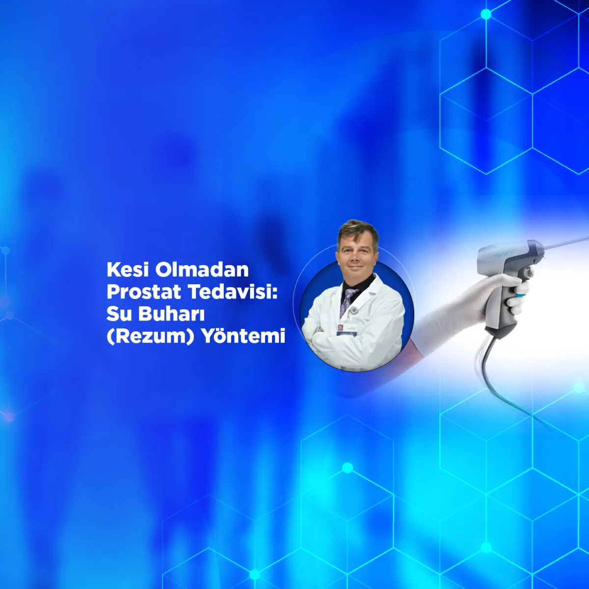 Kesi Olmadan Prostat Tedavisi: Su Buharı (Rezum) Yöntemi
