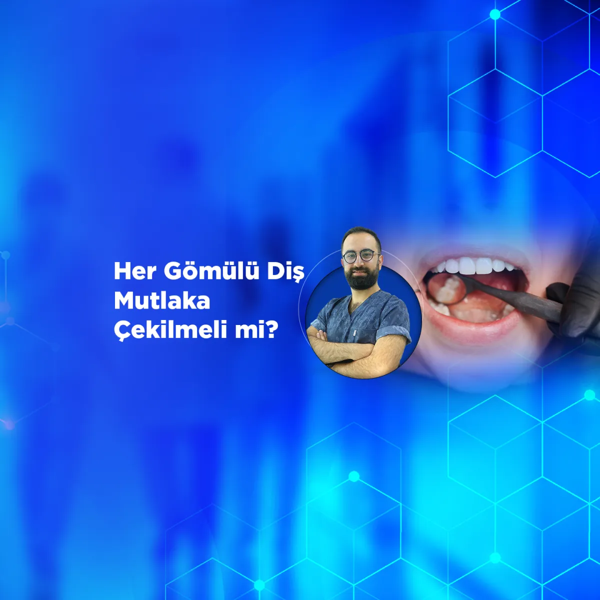 https://youtu.be/vCkk0aJogqg
