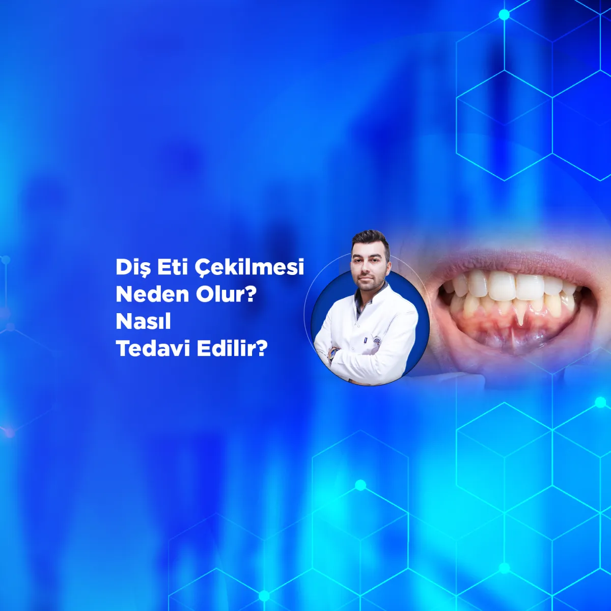 https://youtu.be/0YLrqAI4kcU