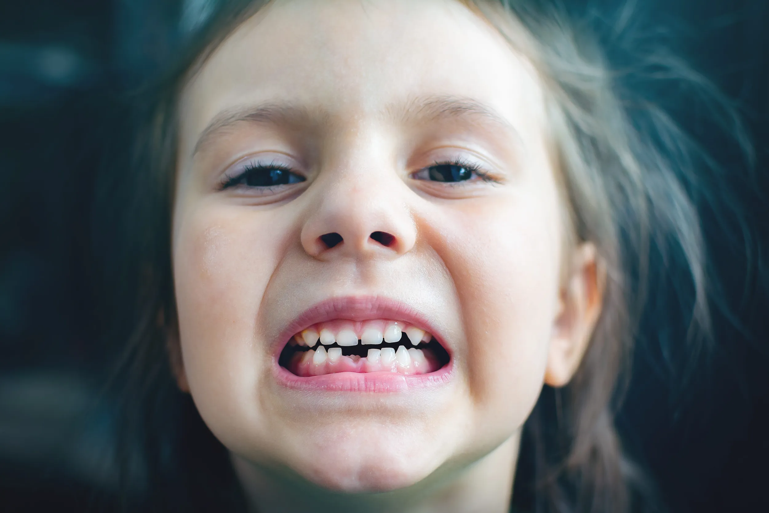 Çarpık dişli kız çocuğu.