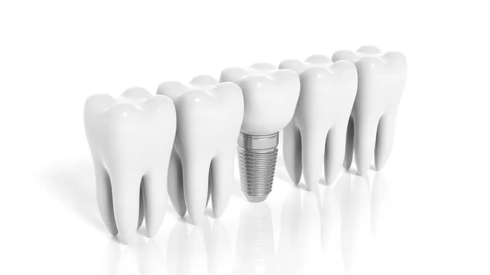 Şeker Hastası Olanlar İmplant Yaptırabilir mi?