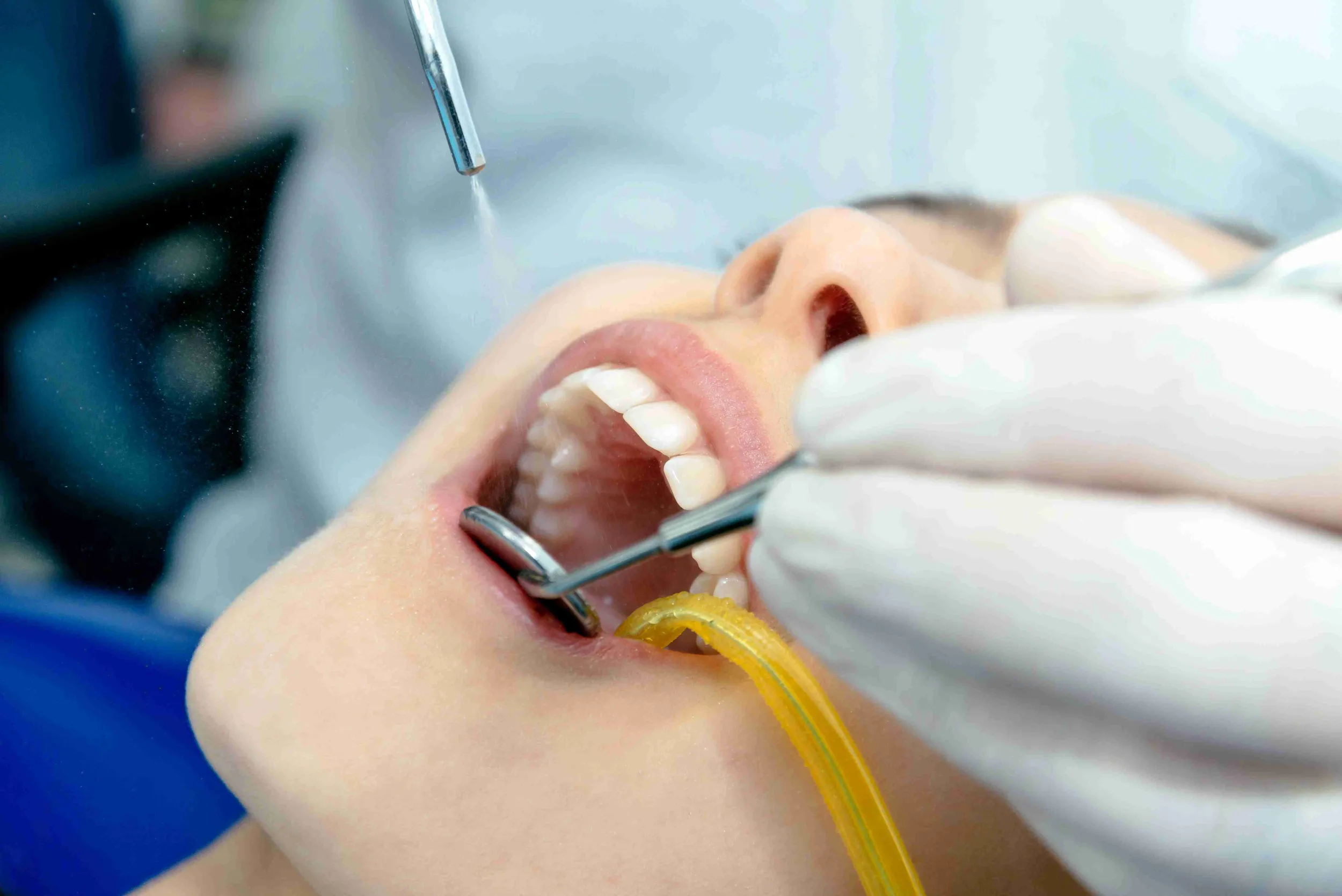 rehberli-dis-temizleme