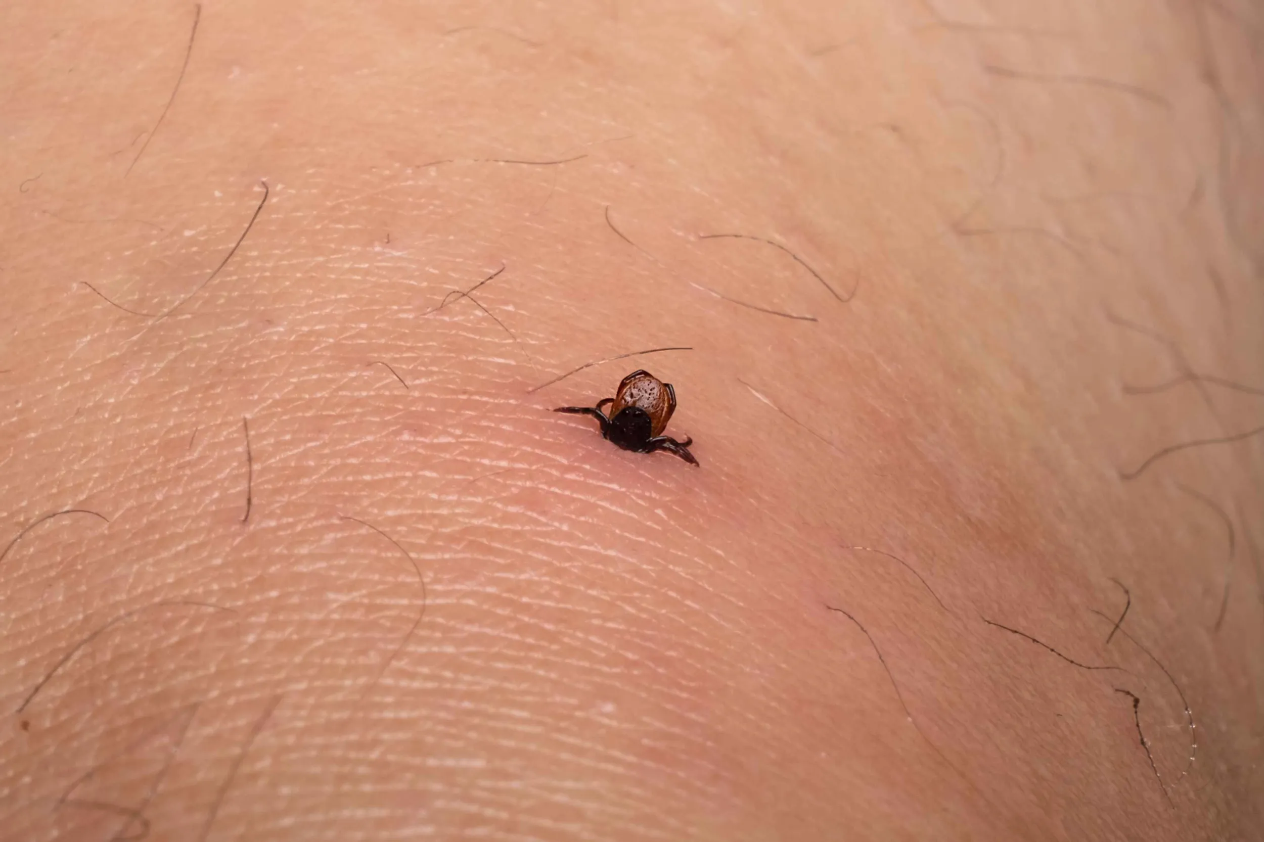 kene-isirigi-goruntusu