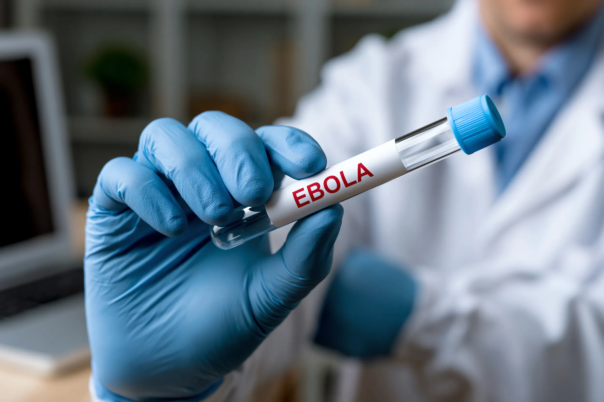 ebola belirtileri ve tedavisi