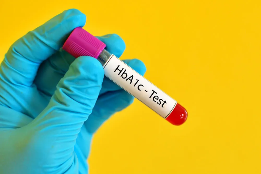 HbA1c Testi Nedir? HbA1c Yüksekliği ve Düşüklüğü