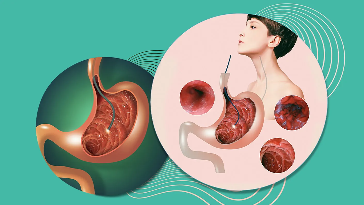 Endoskopi Nedir? Kimlere, Nasıl Uygulanır?