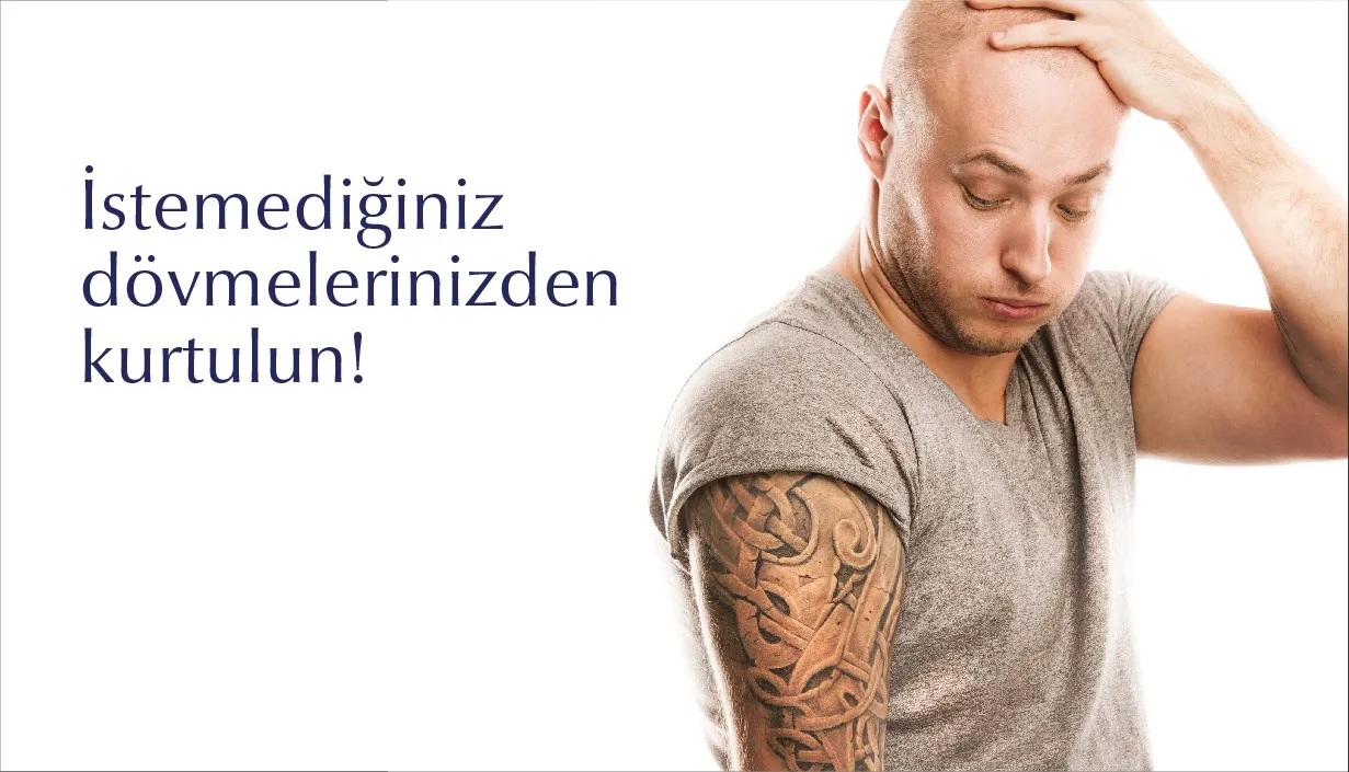 İstemediğiniz Dövmelerden Kurtulun