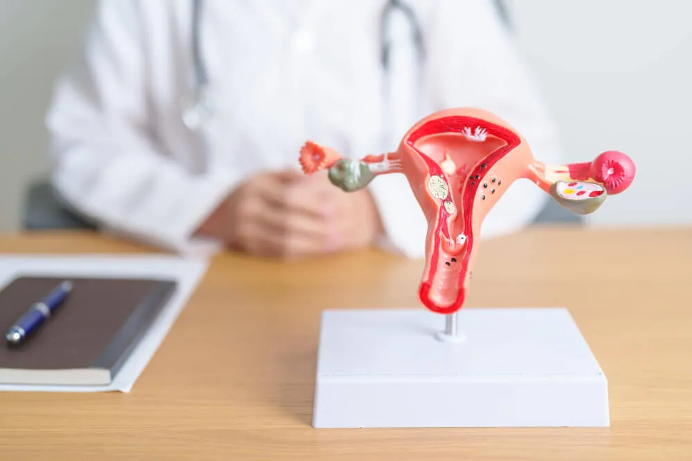 dermoid kist nedir