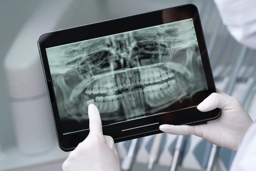 dental tomografi