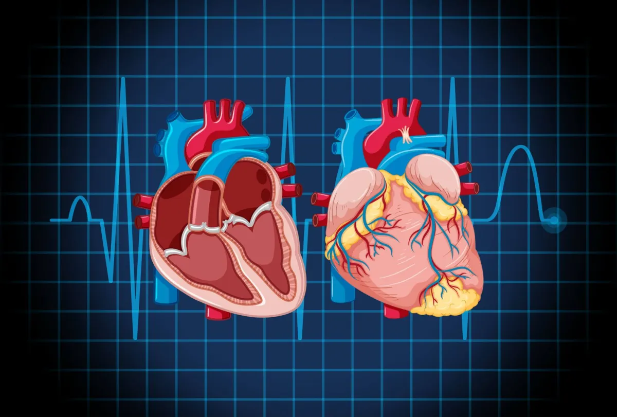 Sol ventrikül yapay kalp destek cihazı (LVAD)