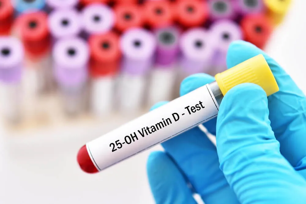 d vitamini testi