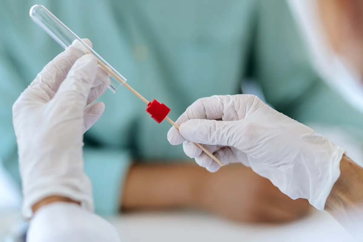 smear testi nedir