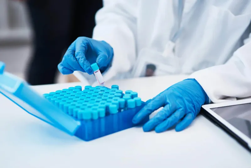 AST Testi Nedir? AST Yüksekliği ve Düşüklüğü