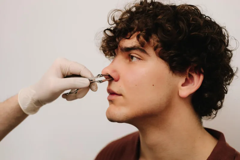 Burun Eğriliği Ameliyatı (Septoplasti) Nedir, Nasıl Yapılır?