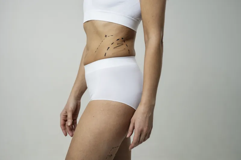 liposuction yöntemleri