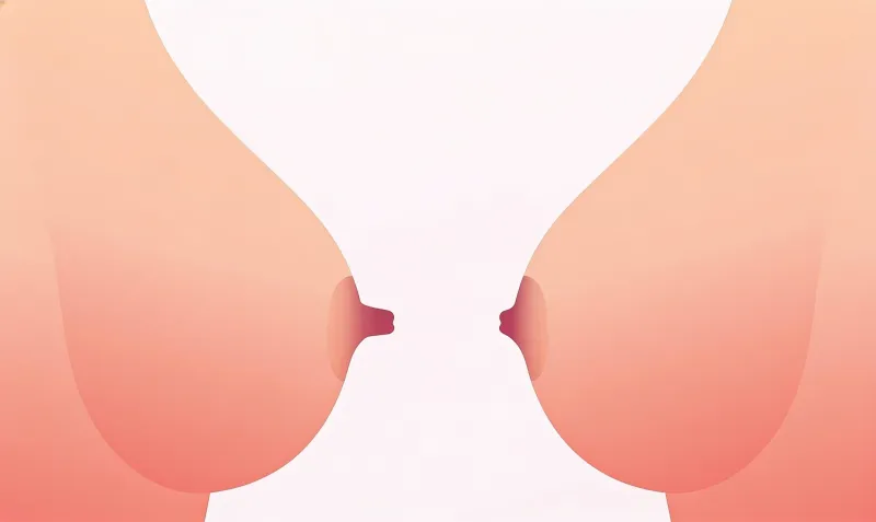 Meme Ucu (Nipple) Küçültme Ameliyatı