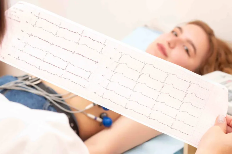  EKG