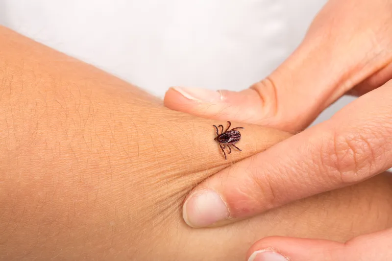 lyme hastalığı
