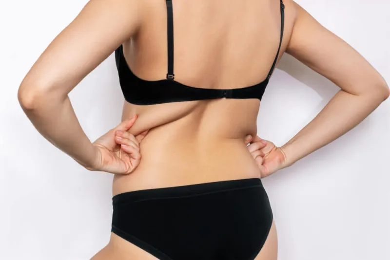 Sırt Liposuction (Sırt Yağı Aldırma) İşlemi Nasıl Yapılır