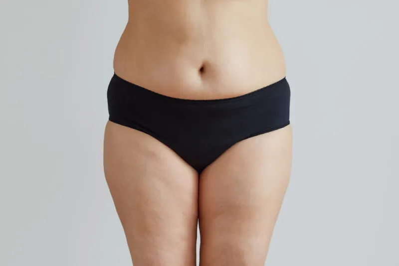 Genital Bölge Kararması Neden Olur
