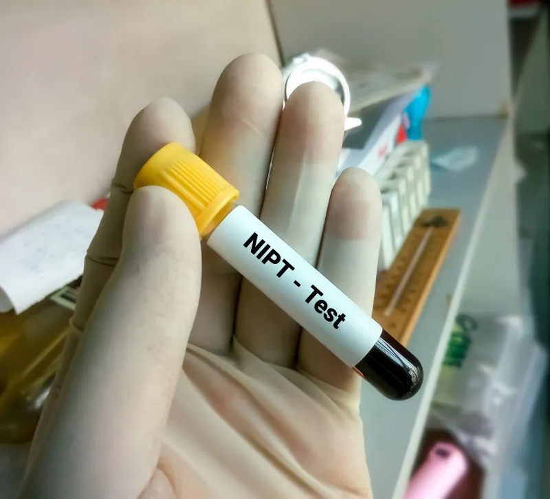 NİPT TESTİ