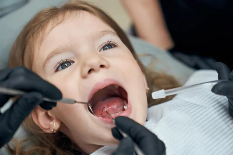 Pediatrik Zirkonyum Kaplamalar Nedir