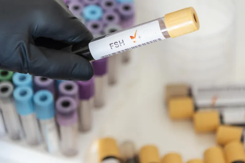 FSH Testi Nedir FSH Yüksekliği ve Düşüklüğü