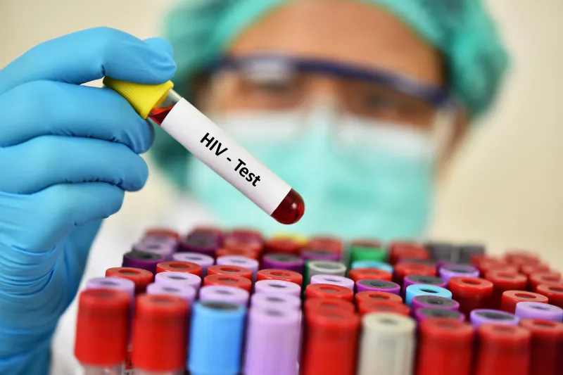 anti hiv pozitif