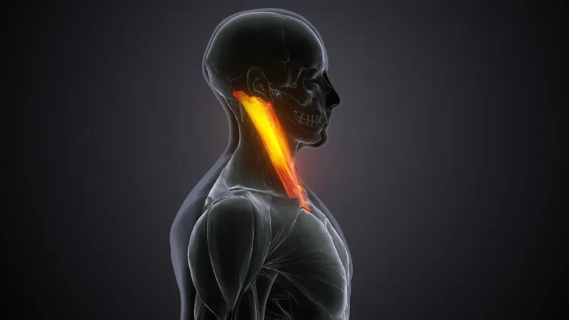 Sternocleidomastoid Nedir