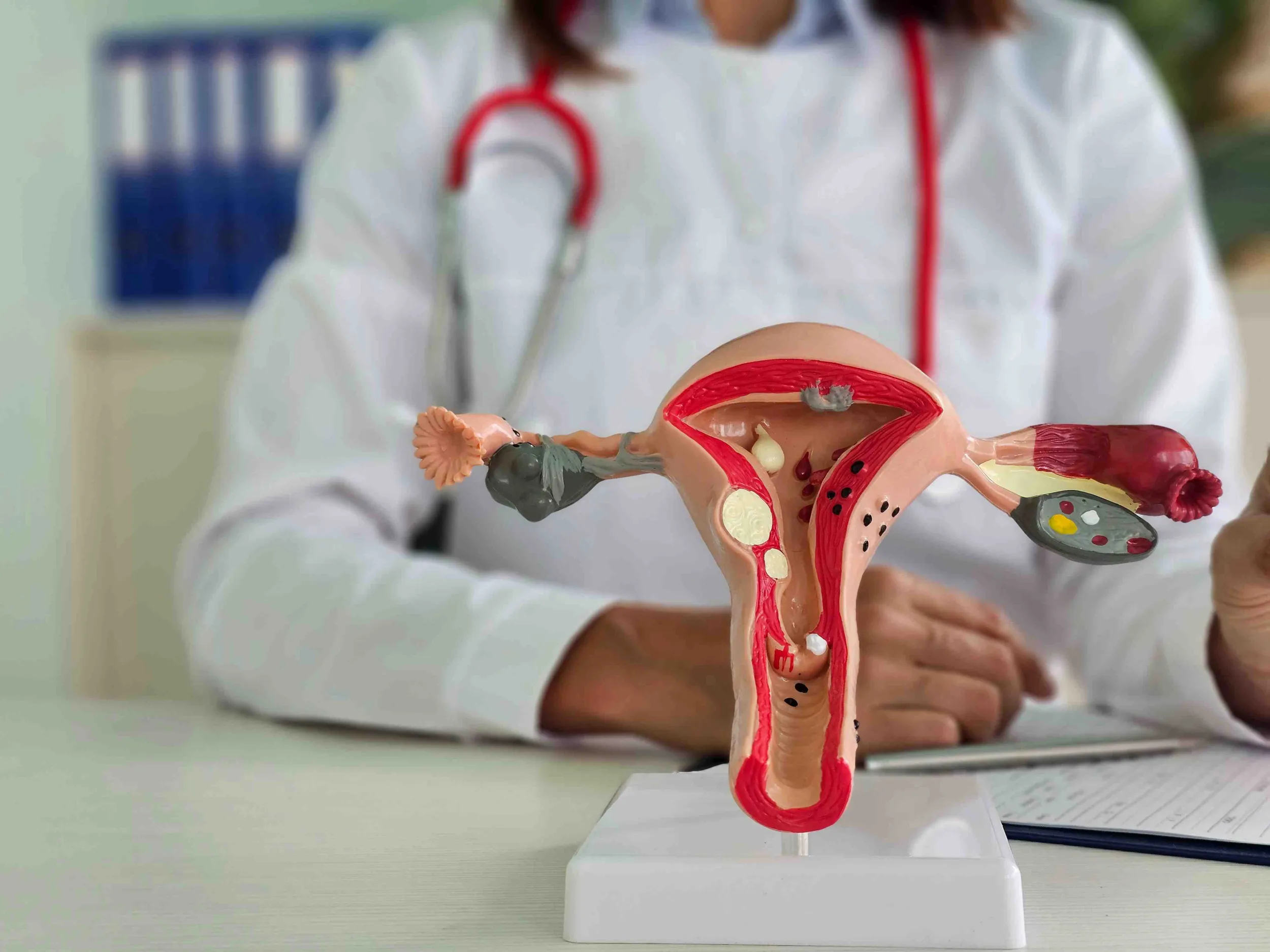 What Is Bladder Stimulation (Sacral Neuromodulation) And How Is It Applied?