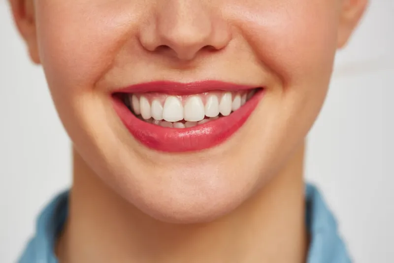 What Are The Natural Teeth Whitening Methods?